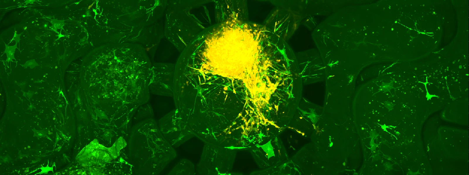 Confocal microscopy image of a spheroid interacting with surrounding cells